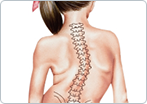 Scoliosis in Children and Adolescents